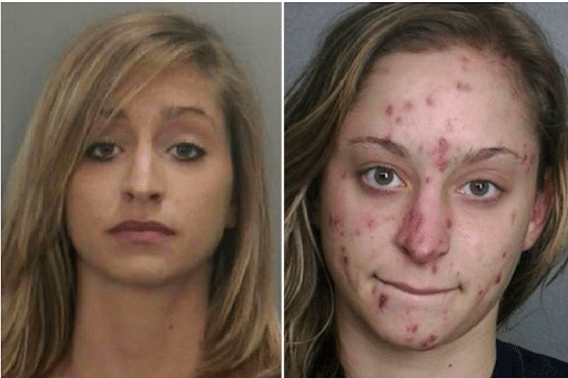 Entry photo for The Top 10 Worst Meth Transformations