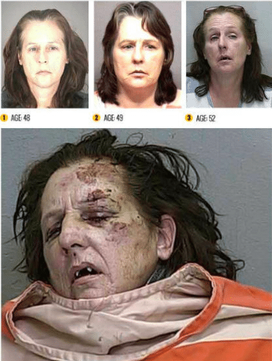 The Top 10 Worst Meth Transformations photo