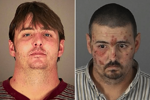 The Top 10 Worst Meth Transformations photo