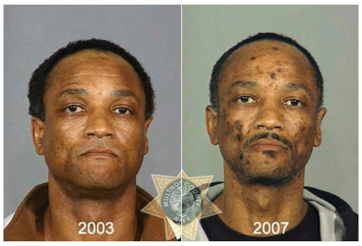 The Top 10 Worst Meth Transformations photo