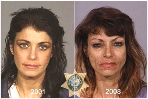 The Top 10 Worst Meth Transformations photo