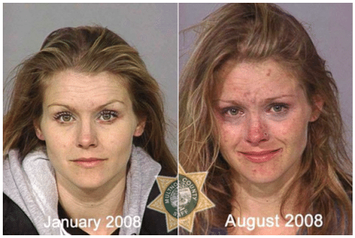 The Top 10 Worst Meth Transformations photo
